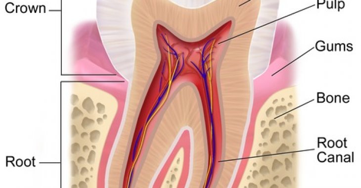 Root Canal and Dental Crown