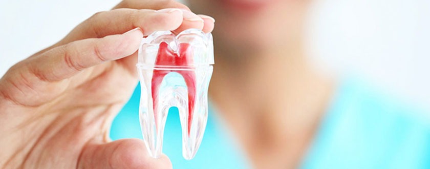 Root Canal Treatment Myths