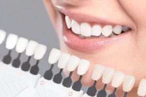 Dental Teeth Whitening