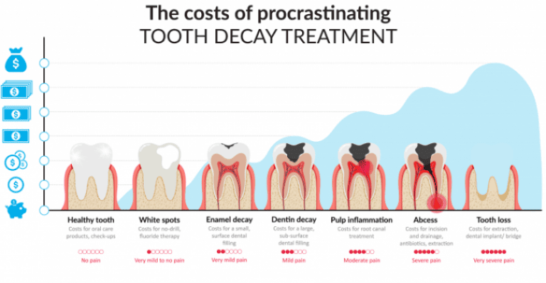 FillWyI3MzAiLCIzODAiXQ-dental-costs-pain-delayed-treatments-768x399